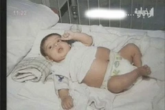 Bé gái đang mang thai. (Nguồn: Internet)