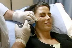 Botox thường được biết đến với tác dụng chống nếp nhăn. (Ảnh: dailymail.co.uk)