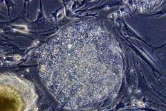 Tế bào gốc. Ảnh minh họa. (Nguồn: Internet)