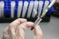 Ảnh minh họa. (Nguồn: topnews.in)