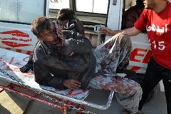 Chuyển người bị thương trong vụ đánh bom tới bệnh viện. (Nguồn: THX/TTXVN)