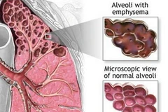 Ảnh minh họa. (Nguồn: Internet)