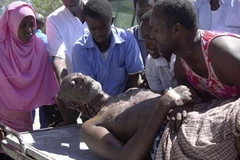 Một dân thường bị thương trong vụ nã đạn cối của phiến quân. (Nguồn: Reuters)