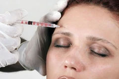 Bệnh nhân đang được tiêm Botox. (Nguồn: Internet)