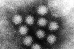 Siêu vi khuẩn norovirus. (Nguồn: Internet)