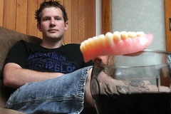 Kennewell William và hàm răng giả của mình. (Nguồn: adelaidenow)