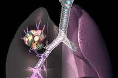 Ảnh minh họa. (Nguồn: Internet)