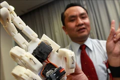 Giáo sư Liu Yun-hui cùng "bàn tay robot". (Nguồn: Internet)