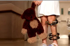 Ảnh minh họa. (Nguồn: polio.emedtv.com)