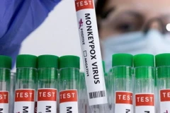 WHO đặt tên mới cho các chủng virus gây bệnh đậu mùa khỉ