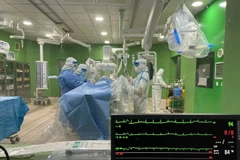 Cấp cứu thành công bệnh nhân mắc COVID-19 bị nhồi máu cơ tim