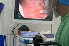 Cứu sống bệnh nhân tâm thần nuốt cây kéo và thanh kim loại vào bụng