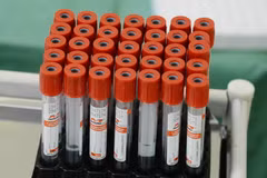 Nga phát triển công nghệ phát hiện virus SARS-CoV-2 ở giai đoạn sớm