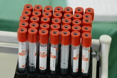 Nga phát triển công nghệ phát hiện virus SARS-CoV-2 ở giai đoạn sớm