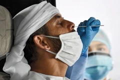 Một thiết bị thử nghiệm COVID-19 dựa trên laser được công bố tại Abu Dhabi vào ngày 19/5. (Nguồn: AFP)