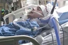 Thanh niên 26 tuổi mất mạng vì nhiễm trùng do răng sâu