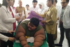 Cậu bé béo nhất thế giới Arya Permana. (Ảnh: Trần Chiến/Vietnam+)