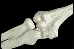 Ảnh minh họa. (Nguồn: coviet.vn)