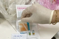 Mẫu cá khoai test nhanh tại chợ Hải Phú (Bố Trạch) có kết quả dương tính với formol. (Nguồn: Báo Quảng Bình) 