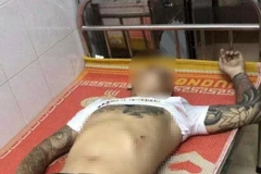 Một người bị trúng đạn được đưa đi cấp cứu tại cơ sở y tế. (Nguồn: Báo Khánh Hòa)