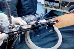 (Ảnh minh họa: Dương Ngọc/TTXVN)