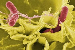 Vi khuẩn Salmonella. (Nguồn: Space.com)