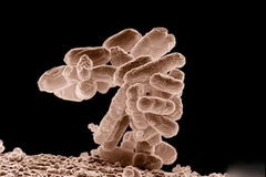 Khuẩn E.Coli. (Ảnh minh họa. Nguồn: Internet)