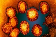 Virus Tây sông Nile. (Nguồn: nhs.uk)