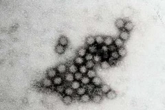 Siêu vi khuẩn norovirus. (Ảnh: Internet)