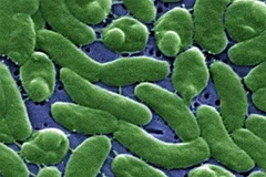 Vi khuẩn Vibrios. (Nguồn: Internet)