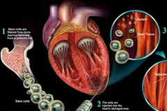 Ảnh minh họa. (Nguồn: ptei.org)