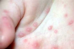 Ảnh minh họa. (Nguồn: Internet)