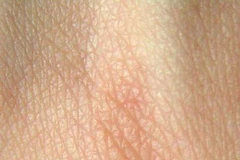 Da nhân tạo. (Ảnh minh họa. Nguồn: Internet)