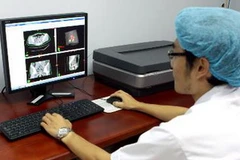 Trình diễn hệ thống phần mềm xạ trị áp sát cho bệnh ung thư. (Ảnh: Dương Ngọc/TTXVN)