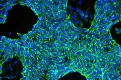 Ảnh phóng to của một tiền tố thần kinh. (Nguồn: news.wisc.edu)