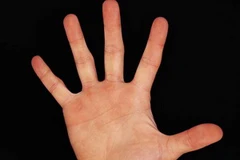 (Ảnh minh họa: Internet).