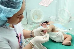Nhân viên y tế lấy mẫu máu gót chân sàng lọc dị tật bẩm sinh cho trẻ sơ sinh. (Ảnh: Dương Ngọc/TTXVN)