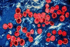 Hình ảnh virus đậu mùa khỉ dưới kính hiển vi. (Ảnh: Getty Images/TTXVN)