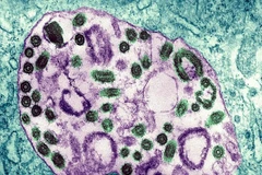 Virus Marburg khiến nhiều người ở Guinea Xích đạo tử vong. (Nguồn: Getty Images)