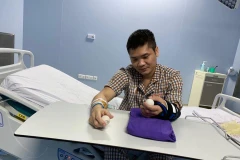 Bệnh nhân may mắn được ghép chi thể là anh Phạm Văn Vương ở Hà Nội. (Ảnh: T.G/Vietnam+)