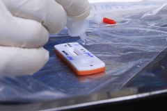 Đại dịch COVID-19 không thể chấm dứt trước năm 2023. (Ảnh: TTXVN/Vietnam+)