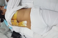 Bệnh nhân điều trị tại Bệnh viện Hữu nghị Việt Đức. (Ảnh: PV/Vietnam+)