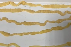 Sán dây bò dài 6m lấy ra từ cơ thể nữ bệnh nhân. (Ảnh: PV/Vietnam+)