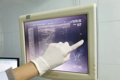 Chiếc máy siêu âm vận hành suốt 20 năm nay tại Bệnh viện Đa khoa huyện Thường Xuân, Thanh Hóa. (Ảnh: PV/Vietnam+). (Ảnh: T.G/Vietnam+)