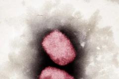 Virus đậu mùa khỉ nhìn dưới kính hiển vi. (Ảnh: AFP/TTXVN)