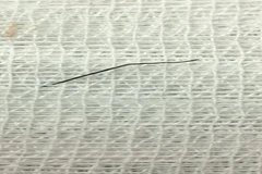 Dị vật được các bác sĩ lấy ra từ trong bụng của bệnh nhân. (Ảnh: PV/Vietnam+)