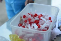 Ống đựng mẫu xét nghiệm COVID-19. (Ảnh: Văn Dũng/TTXVN)