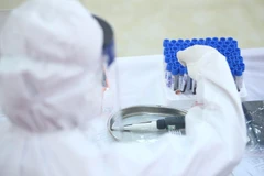Lấy mẫu xét nghiệm nhanh COVID-19. (Ảnh: Minh Quyết/TTXVN)
