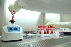 Phân tách mẫu xét nghiệm COVID-19 qua chạy máy ủ lắc. (Ảnh: Minh Quyết/TTXVN)