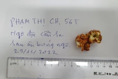 Mẫu bỏng ngô bệnh nhân đã sử dụng do gia đình cung cấp. (Ảnh: PV/Vietnam+)